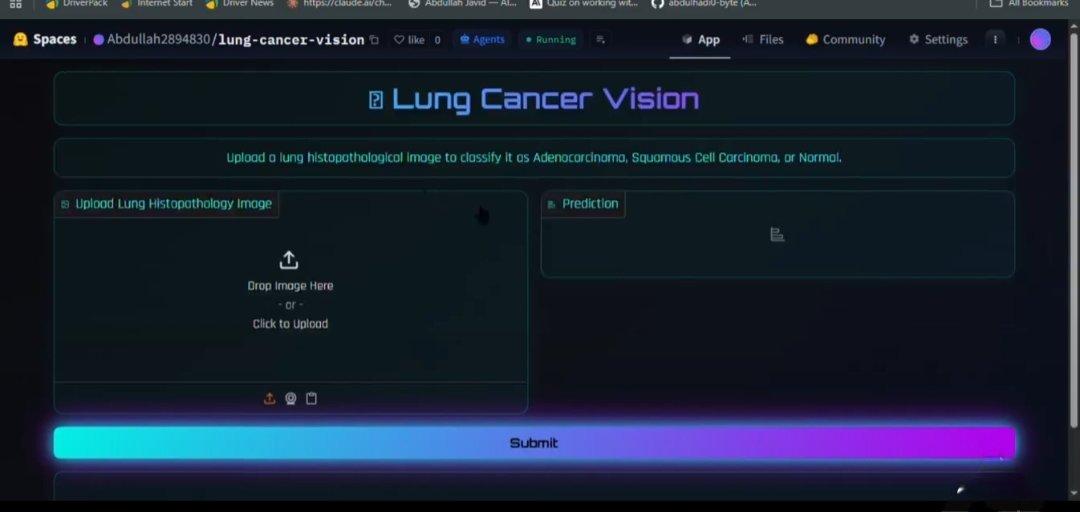 Lung Cancer Vision screenshot