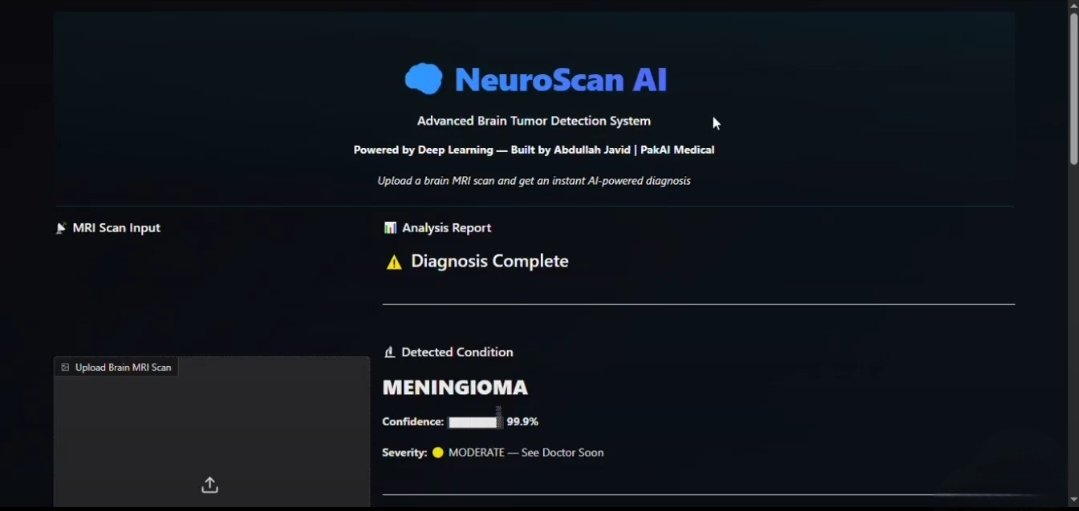 NeuroScan AI screenshot